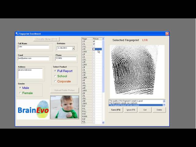 DMIT Fingerprint Analysis - Multiple Intelligences Test