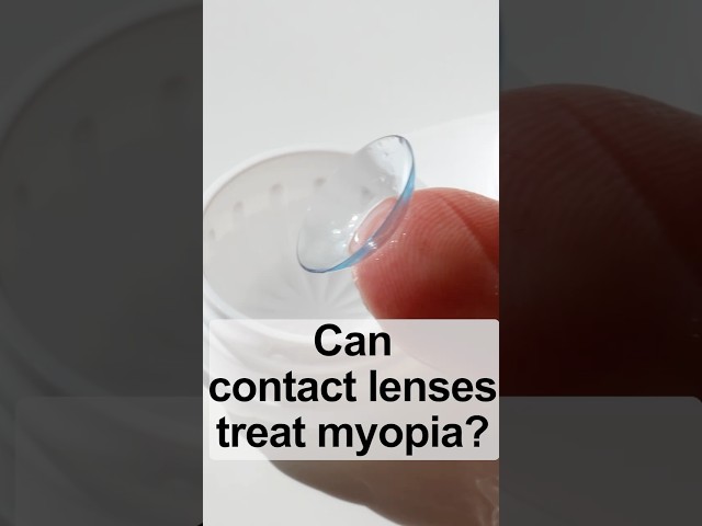 Can contact lenses treat myopia?
