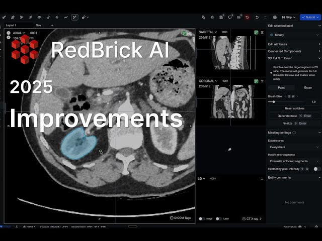 Redbrick AI - What's new from 2025