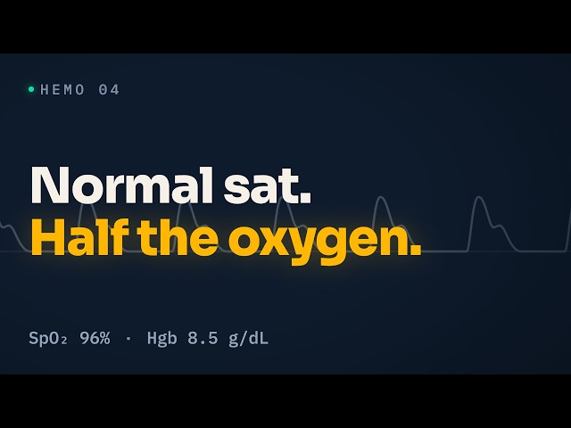 Oxygen Delivery (DO₂): Why a Normal Sat Still Starves Tissue (HEMO 04)