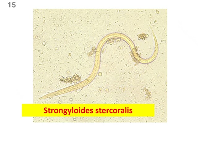 Computerized Lab 2/3: Opportunistic Parasites, Intestinal Protozoa & Nematodes | ID + Quiz