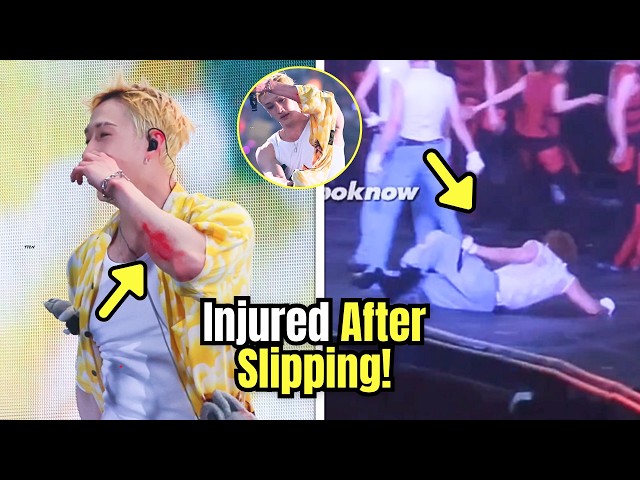 Stray Kids’ Bang Chan Injured After Slipping On Wet Stage During Japan Concert!