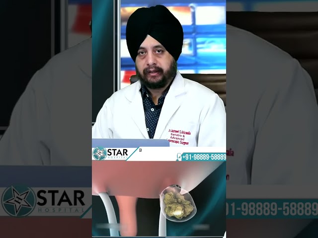 What Is Inguinal Hernia? Inguinal Hernia Meaning In Hindi | Inguinal Hernia | Inguinal Hernia Repair