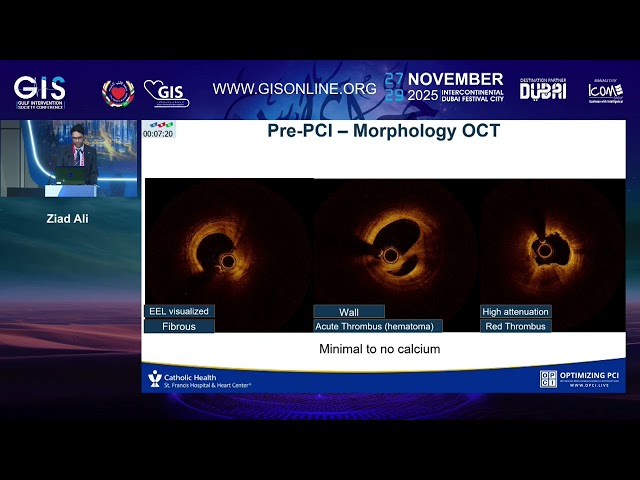 16 MLD MAX   The Universal PCI Algorithm Ziad Ali