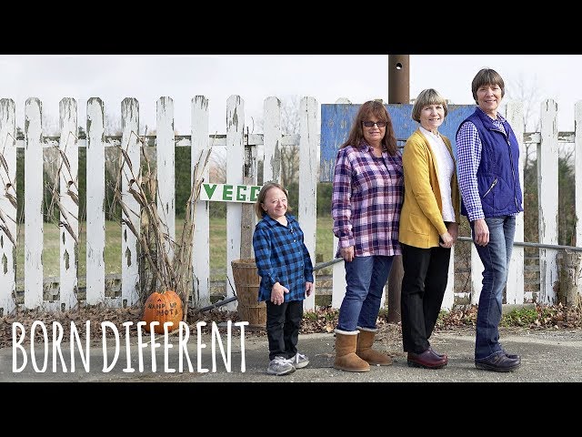 My Rare Dwarfism Makes Me One In 500 Million | BORN DIFFERENT