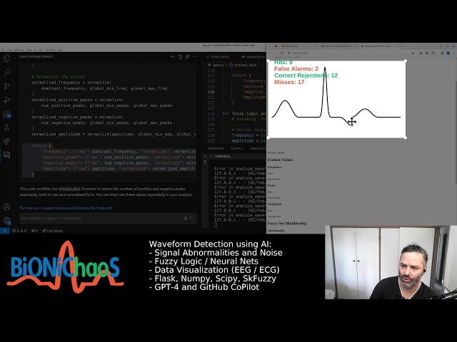 ECG Analysis with AI: Fuzzy Logic Enhancements and the Interactive ECG Game