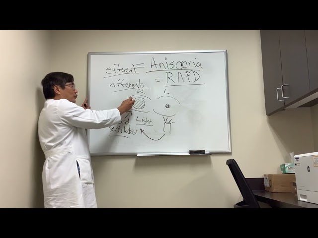 RAPD and anisocoria