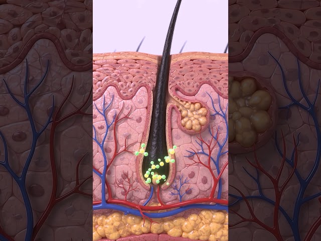3D animation of a shrinking hair follicle showing dht hormone effect