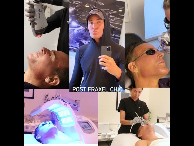 An Inside Look into Dr. Frank's Favorite Pro-Aging Treatment, Healing, and Post-Care