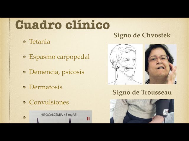 Calcium: Hypocalcemia and hypercalcemia