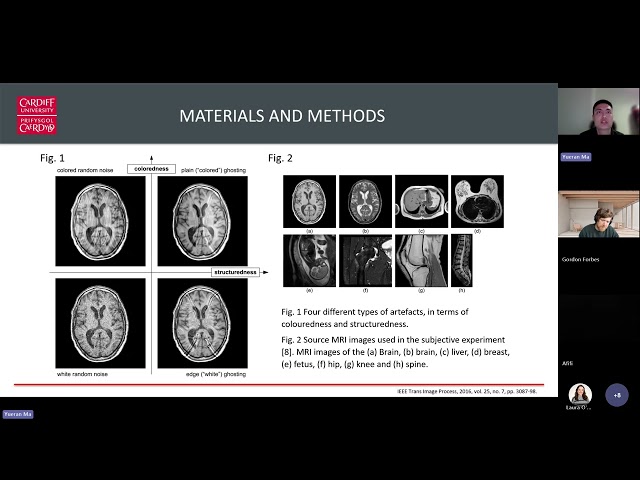 Modelling Visual Perception and Image Quality for Medical Imaging
