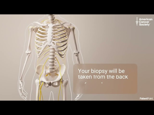 Bone Marrow Biopsy Procedure: What to Expect