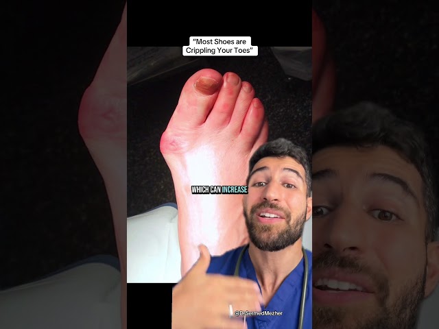 “Most Shoes Are Crippling Your Toes” #how