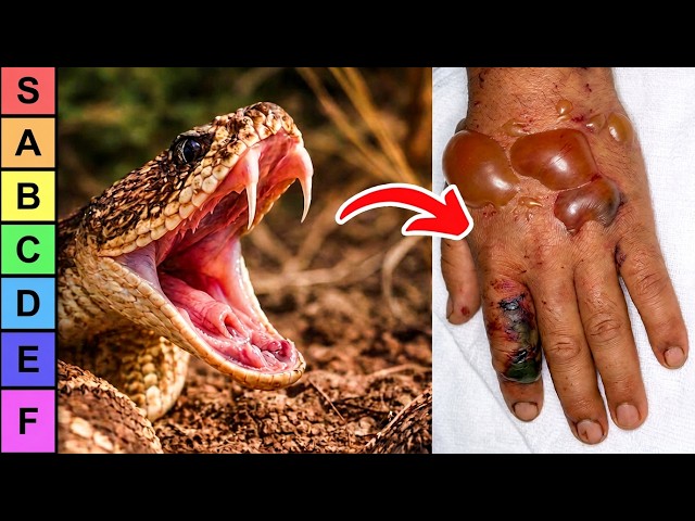 The DEADLIEST Snake Bites On Earth (Tier list)