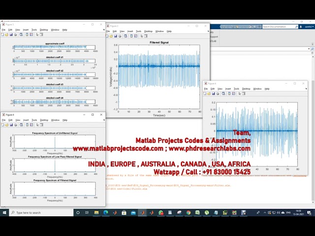 ECG SIGNAL PROCESSING | MATLAB PROJECTS | WWW.MATLABPROJECTSCODE.COM | WWW.PHDRESEARCHLABS.COM