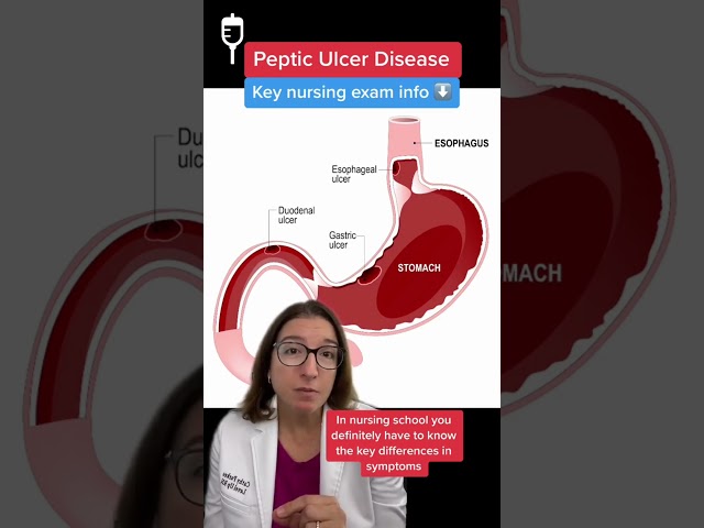 Peptic Ulcers: Medical Surgical SHORT | @LevelUpRN