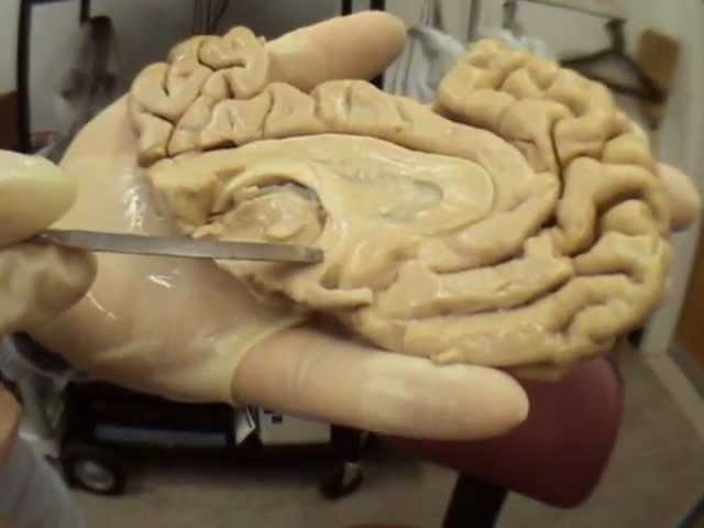 Brain Anatomy