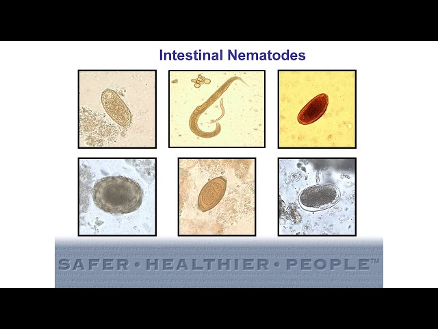 Diagnostic Features of Intestinal Nematodes