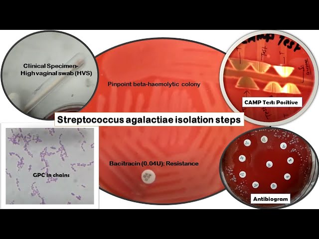 Streptococcus agalactiae isolation steps-Gram stain, Bacitracin susceptibility, CAMP, Antibiogram