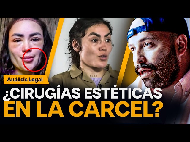 ¿Epa Colombia se realizó cirugías estéticas en la cárcel? #derechopalagente