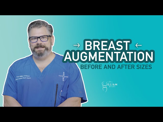 Breast Augmentation Before and After Sizes