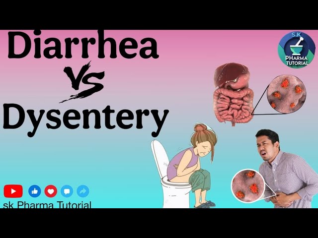 Diarrhea ||vs||. Dysentery:|| Key Difference Explained|| # S.K Pharma Tutorial ||# Health tips 