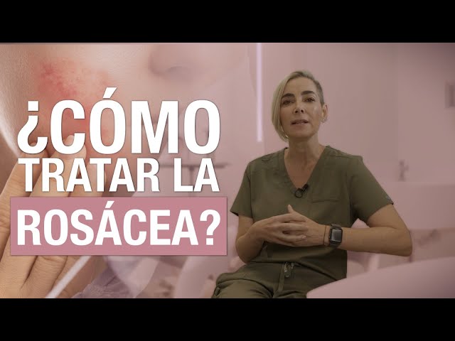 Cómo tratar la rosacea