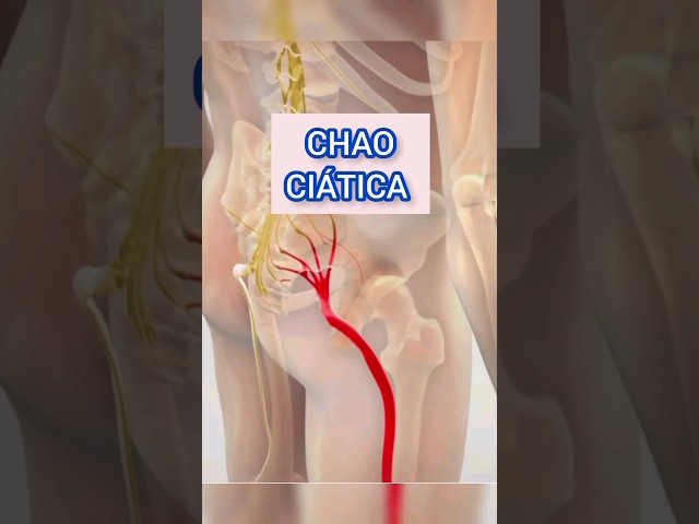 CHAO CIÁTICA