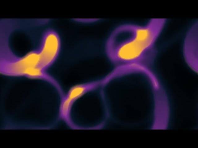 kinetic anisotropic perona malik diffusion 2d