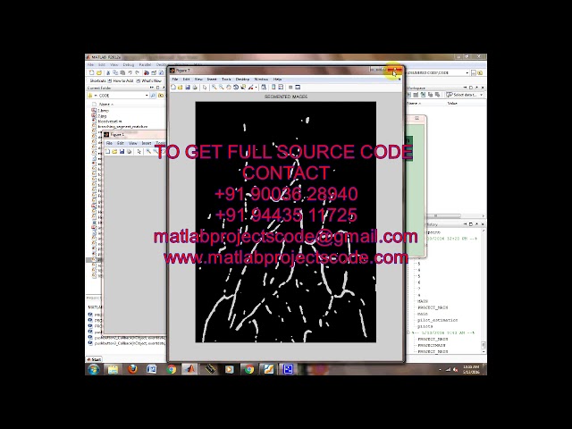 Matlab code for Laryngeal tumour detection & classification in endoscopic video