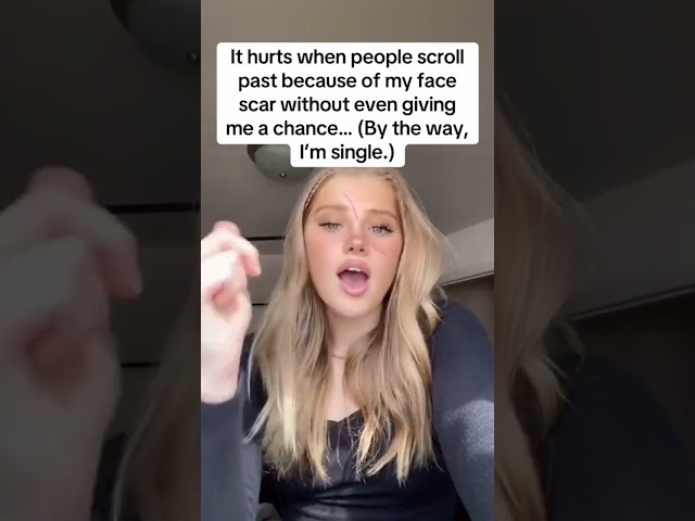 I'm single mom 32 y,o with scars on face #over50 #singlemoms