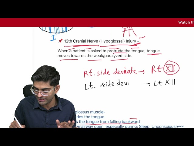 Hypoglossal nerve palsy | TCML App