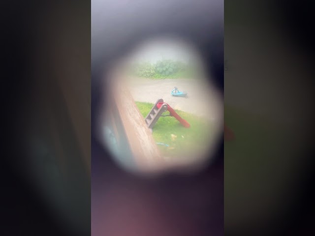 Vision Simulations of Various Eye Conditions #vision #simulation