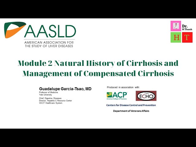 Module 2 Natural History of Cirrhosis and Management of Compensated Cirrhosis