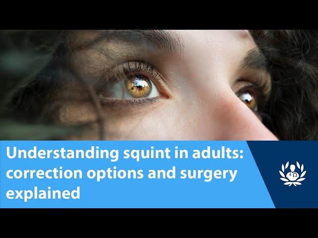 Understanding squint in adults: correction options and surgery explained