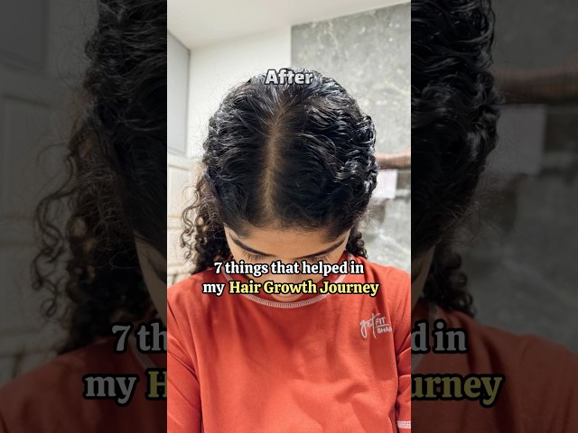 7 things that helped in my hair growth journey #hairfall #hairgrowth #youtubeshorts
