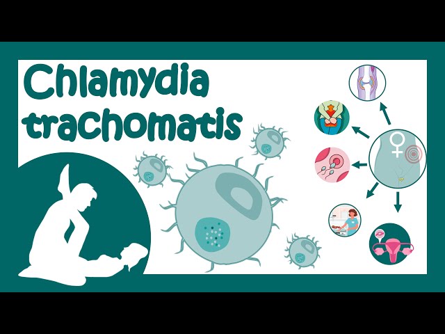 Chlamydia trachomatis | Chlamydial infection | Sexually transmitted disease | Treatment of Chlamydia