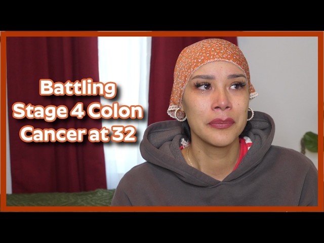 Cáncer de colon en etapa 4 | Actualización