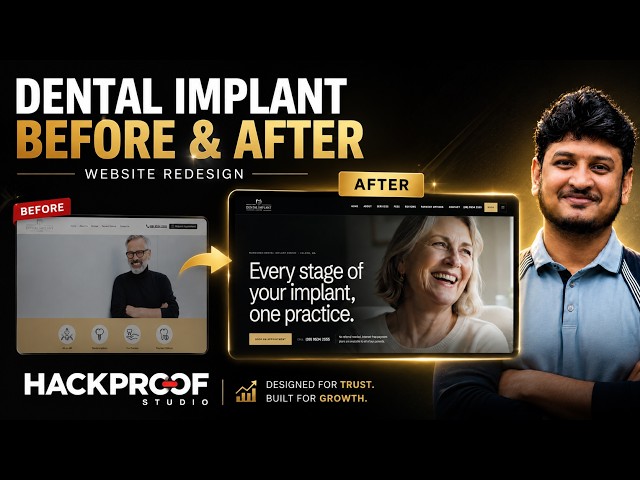 Dental Implant Website Redesign Before & After  Premium Web Design Case Study