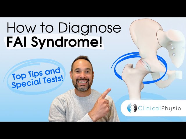 How to Diagnose FAI | Physio explains top tips, signs and tests for femoroacetabular impingement!
