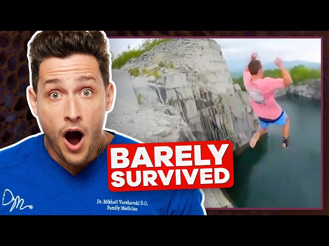 Doctor Reacts To Extreme Sports Injuries