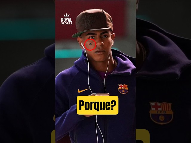 Por que Lamine Yamal lleva estrellas en la cara 😱⚽