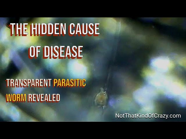 Caught on Camera: Transparent Parasitic Worm Revealed Under Microscope (Albuquerque, 2023)