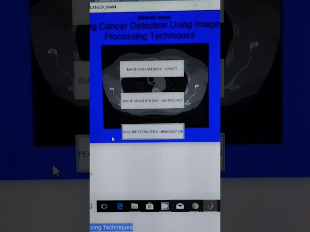 Lung Cancer Detection Using Image Processing Techniques