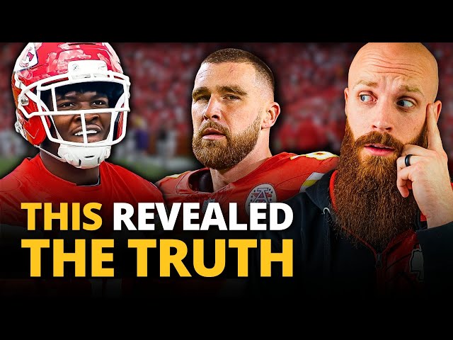 The Chiefs tried to hide this but it's even MORE obvious now