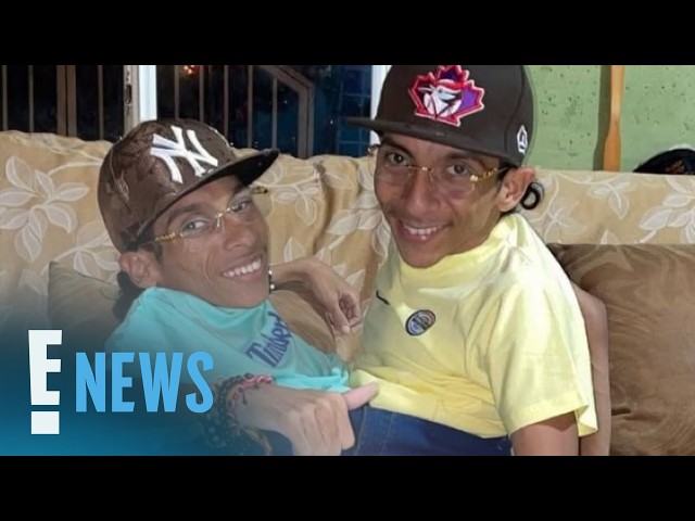 Conjoined Twins José Luis, José Armando Cevallos Dead at 27 | E! News