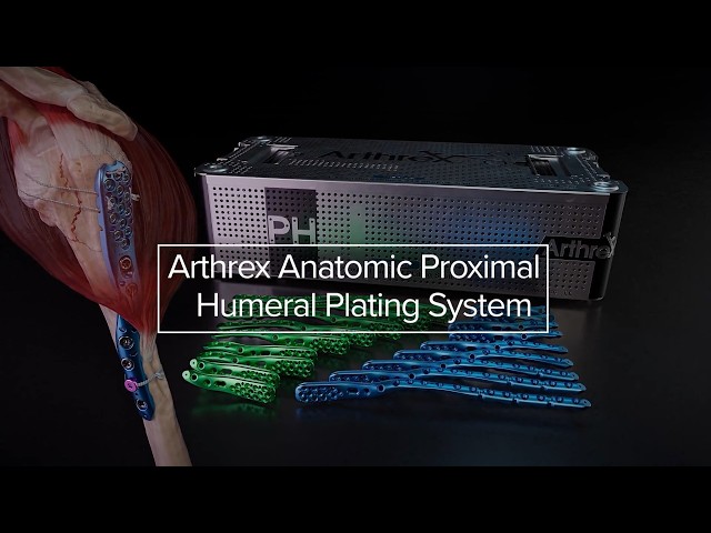 Arthrex Anatomic Proximal Humeral Plating System