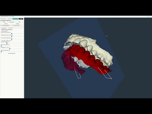 Articulador digital de diagnóstico para ortodoncia.