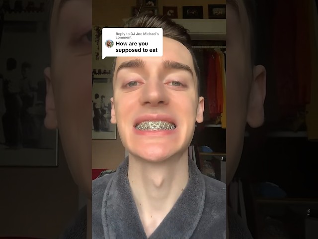 How Can He Even EAT?! 😬🦷