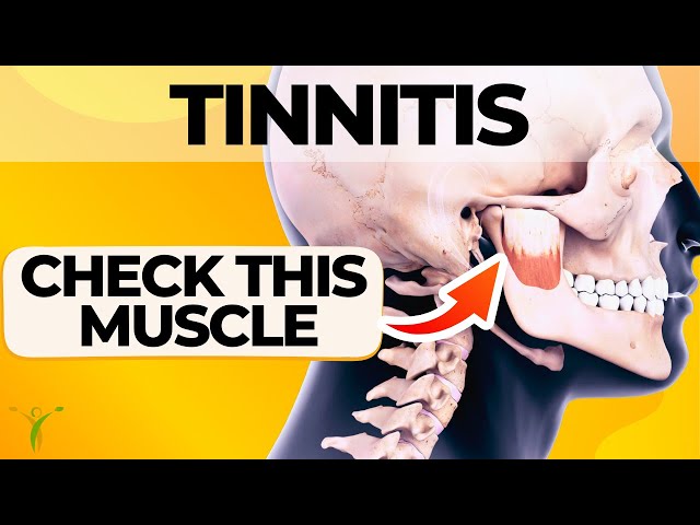 Stop the Ringing! 5 Powerful Strategies for Relieving Tinnitus